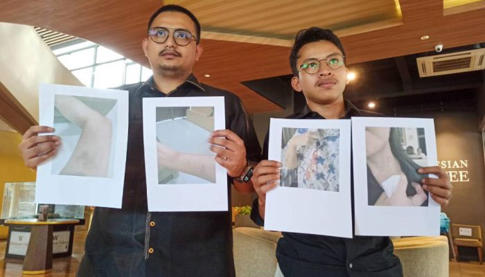 Kasus KDRT di Surabaya Naik Penyidikan, Korban Imud Tolak Mediasi.
